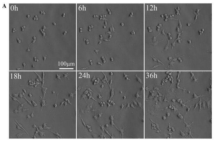 高內涵成像系統對三種多糖免疫調節作用的比較研究